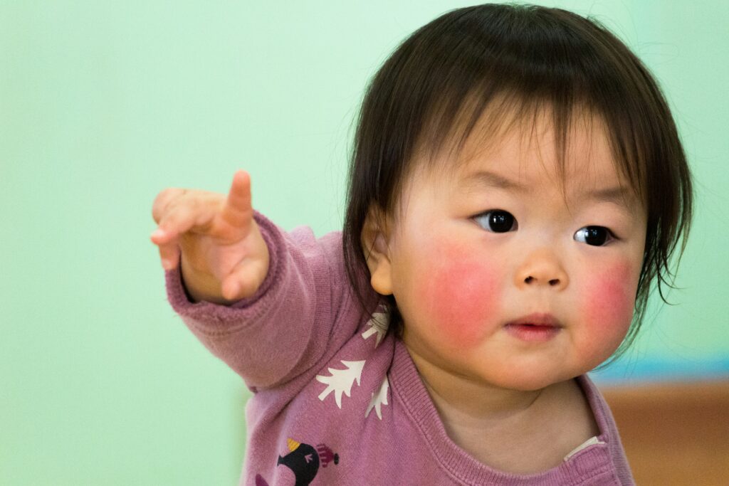 baby girl with flush cheeks